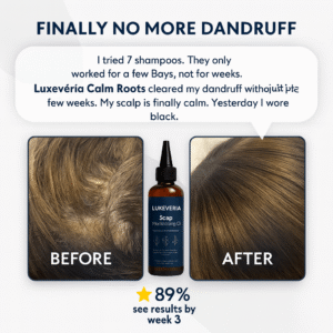 luxevéria Skalp Moisturuzing Oil 9 luxevéria Skalp Moisturuzing Oil