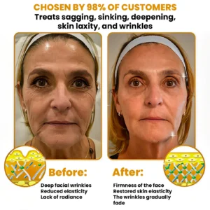 Luxevéria Bee Venom Anti-Wrinkle Cream