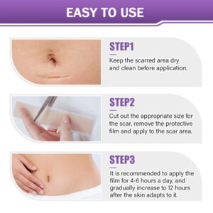 Luxevéria Microneedle Stretch Mark Patch