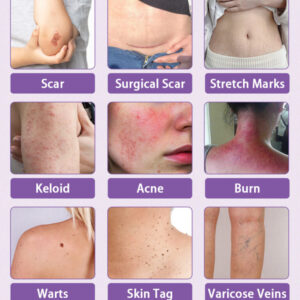 Luxevéria Microneedle Stretch Mark Patch