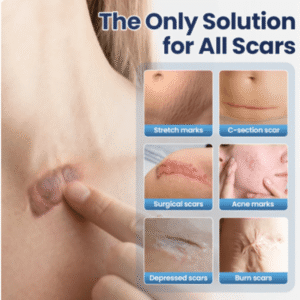 Luxevéria Scar Removal Cream