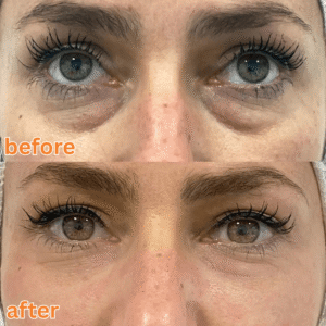 Luxevéria PDRN Under-Eyes Patches Vitamin C Complex