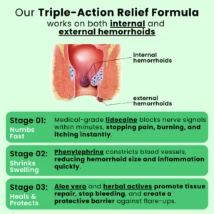Illura Hemorrhoid Ointment with Aloe
